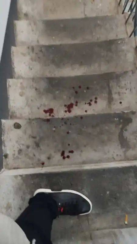 男子斥责遛狗不拴绳被打出血,次日送娃上学遭挑衅尾随,狗主人已被刑拘