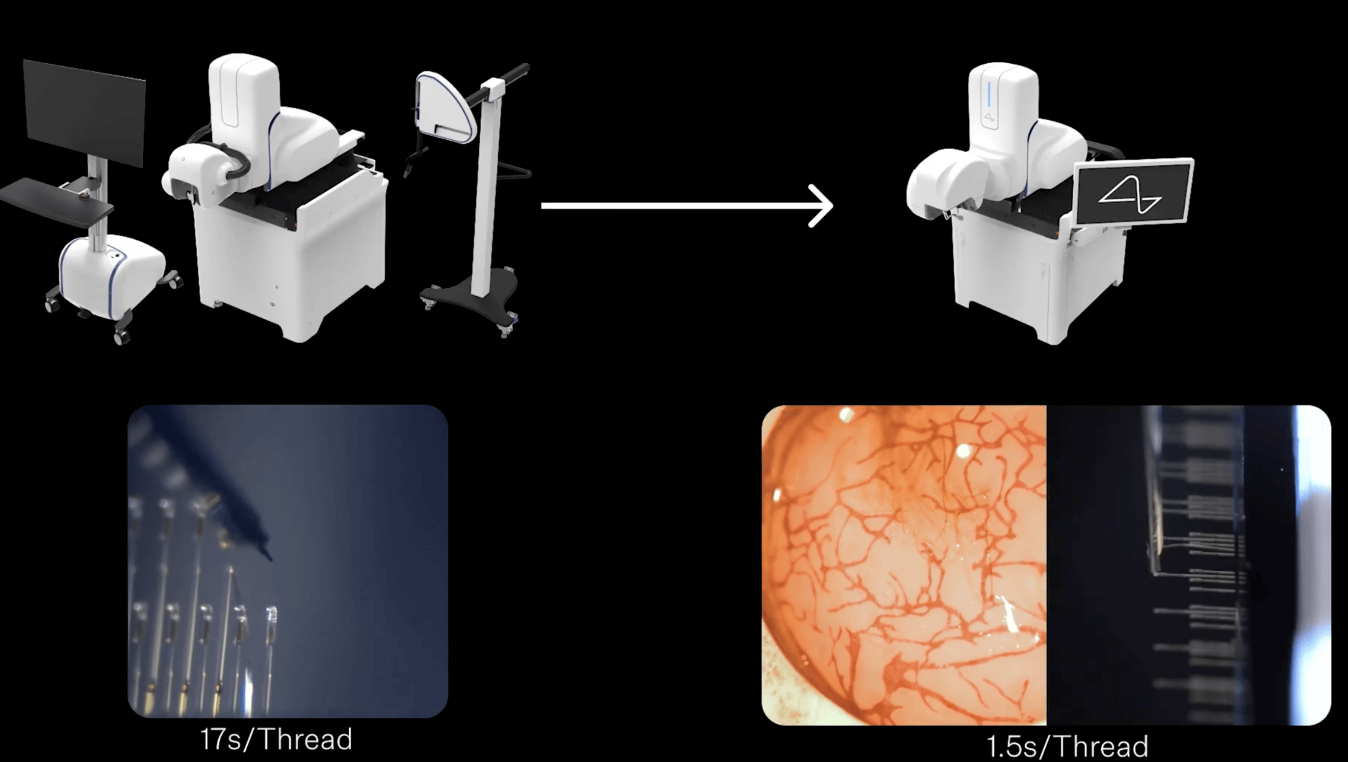 马斯克Neuralink疯狂计划曝光：5万美元一台手术，要把人类变成“超能力机器人”