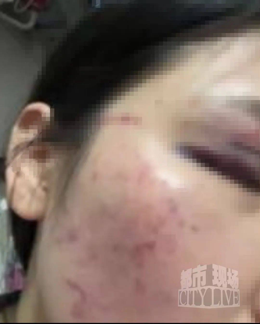 湖南衡阳29岁女子疑被男友施暴后从25楼跳下身亡 男友徐某此前还刺激说:“你放心,她不会去死的”