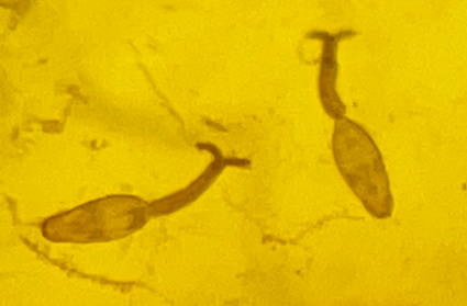 一旦接触,10秒即可感染!汛期谨防这种病→