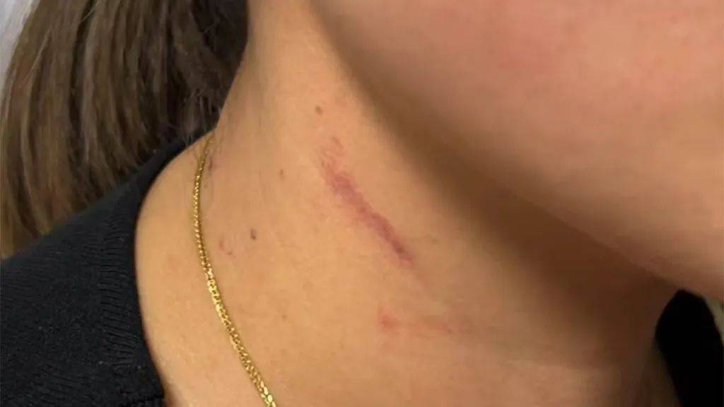 云南一男子酒后逼问妻子“是否出轨”并施暴,被警方行拘4日