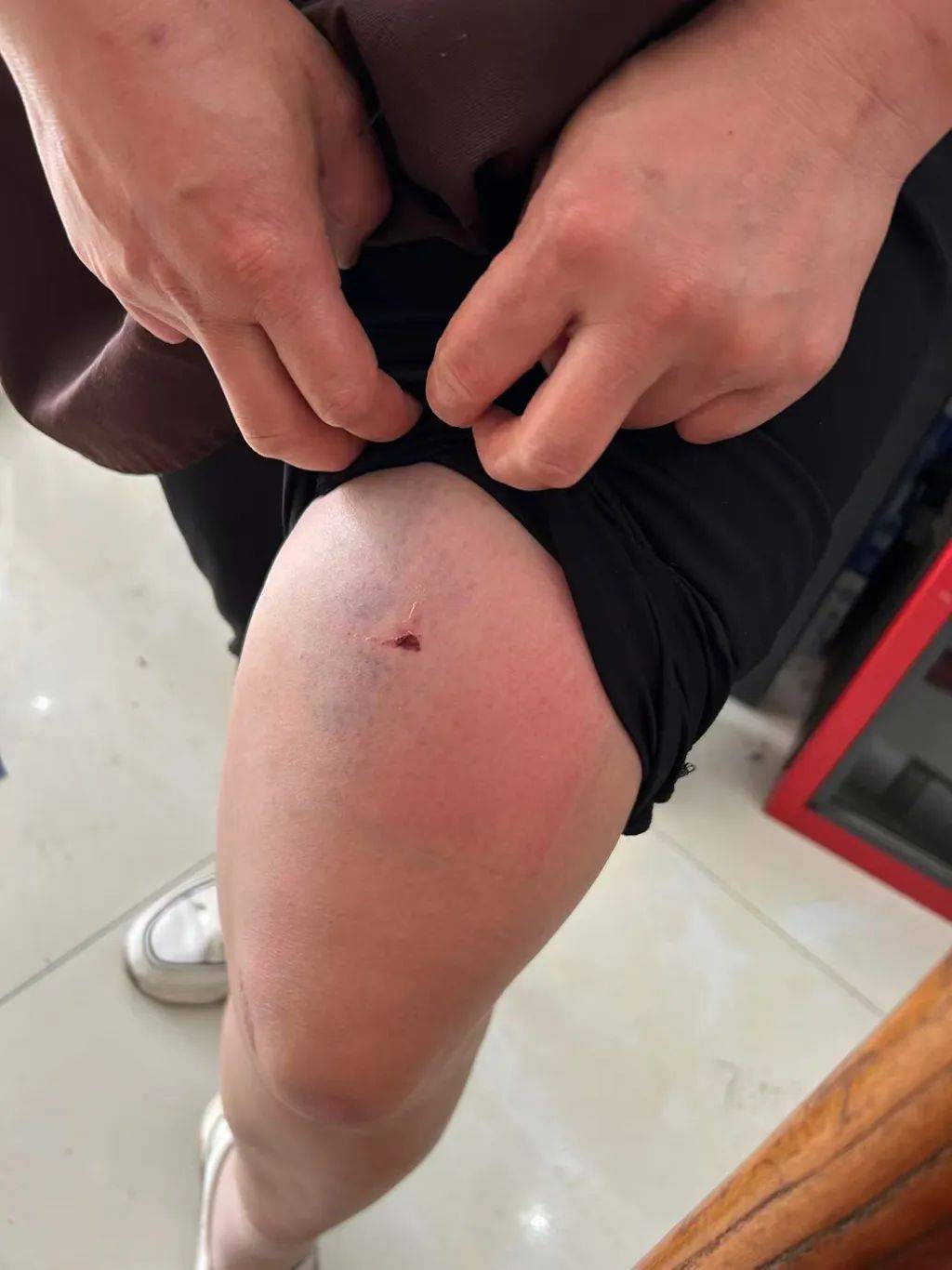 云南一男子酒后逼问妻子“是否出轨”并施暴,被警方行拘4日